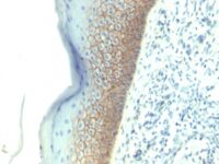 FFPE human skin sections stained with 100 ul anti-E-Cadherin / CD324 (clone SPM381) at 1:50. HIER epitope retrieval prior to staining was performed in 10mM Citrate, pH 6.0.